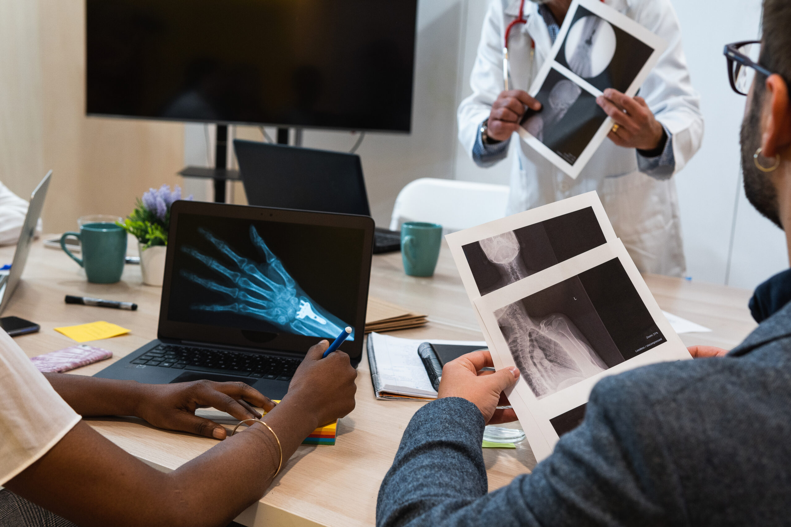 Medical experts reviewing X-ray images together in a clinical meeting, analyzing scans and discussing accurate diagnosis.
